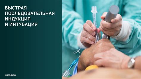 Быстрая последовательная индукция и интубация