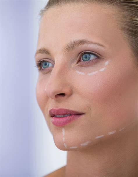 face lift  thread hanger specialist dr pinar bozkurt