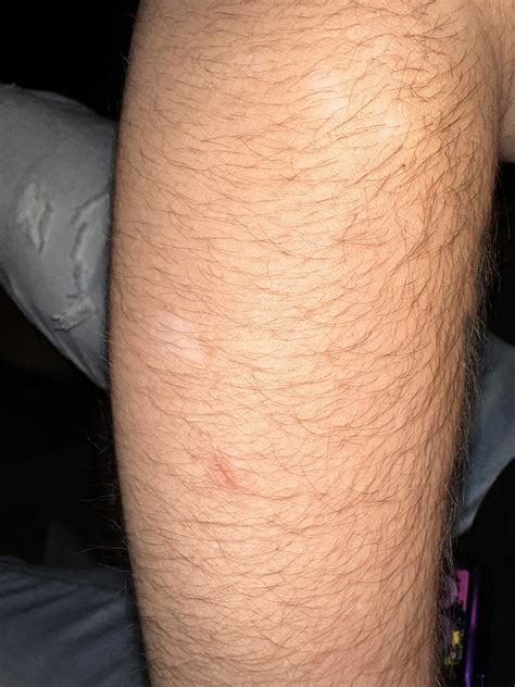 These little pale spots have appeared on my arm over the past couple of