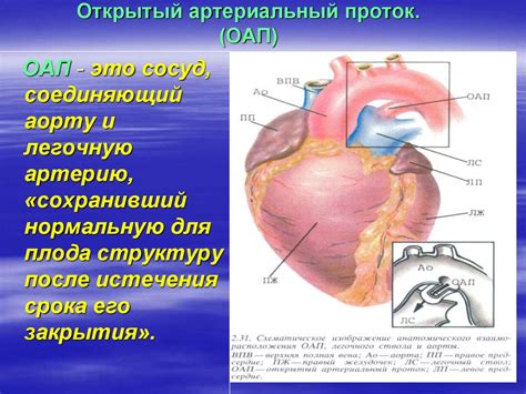 Врожденные пороки сердца у детей - презентация онлайн