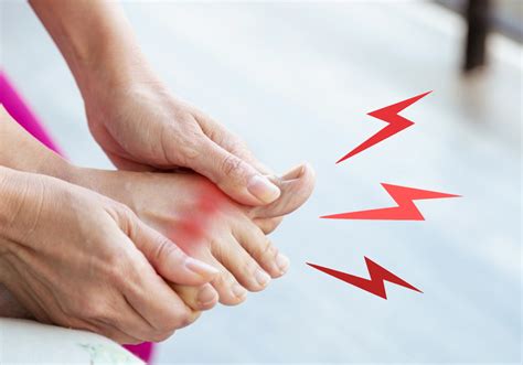 Gout: Symptoms, Causes & Treatment | Blog | Doctor Anywhere