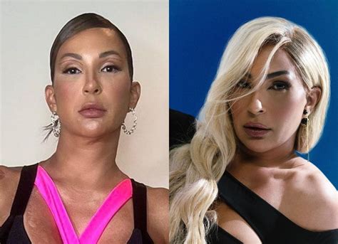 Valesca Antes E Depois - Valesca Popozuda surpreende com harmonização facial no tapete vermelho ...