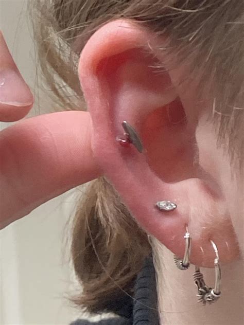 cartilage healing help please!! : r/PiercingAdvice