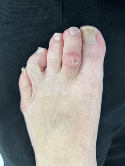 Miscellaneous Before and After Photos | Northwest Surgery Center