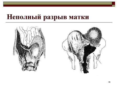 Родовой травматизм - презентация онлайн
