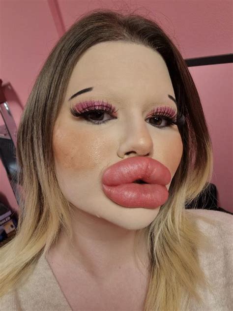 ‘I have the world’s BIGGEST lips – now I want the biggest CHEEKBONES ...