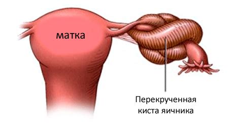 Почему болит низ живота у женщин или тянет в левом или правом боку ...