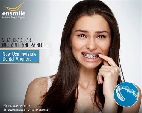 Best invisible aligners - Wasinto