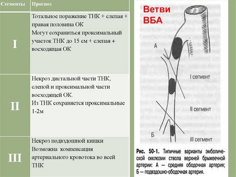 Тромбоз мезентериальных сосудов - презентация онлайн