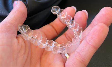 Bite dentale non solo per la salute dei denti ...