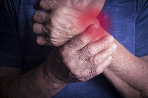 Understanding Arthritis - Homewood Chiropractic Clinic