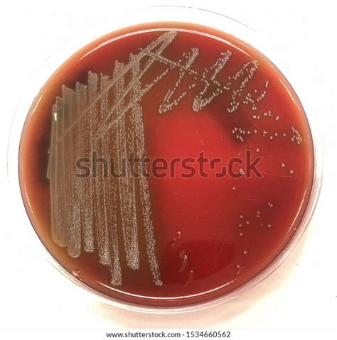 alpha hemolysis  blood  streptococcus stock photo