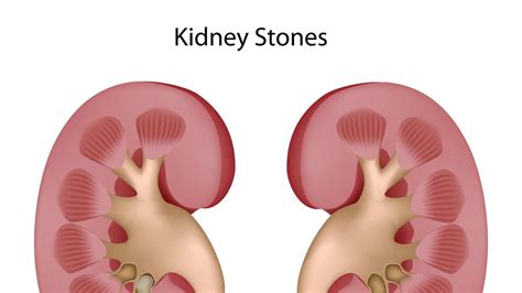 makanan  bikin ginjal sehat
