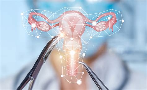 Конизация шейки матки: показания и способы проведения - Medkurs.ru