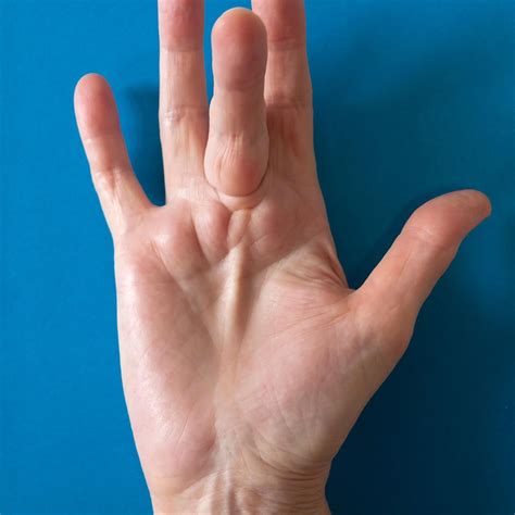Occupational-Based Hand Therapy. Hand therapy is an occupational ...