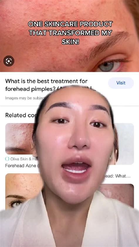 retinol changed her skin it helps with spots, skin texture, fine lines ...