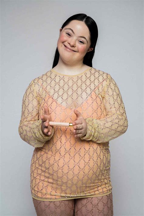 Sindrome De Down Pelada - NAZAEDU