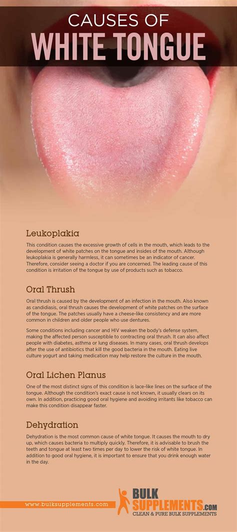 Dehydration Symptoms Tongue