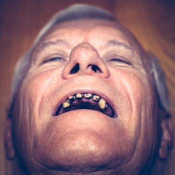 ugly teeth stock   royalty  stock