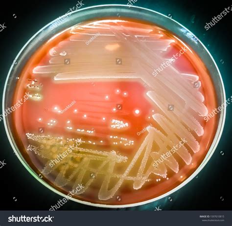 blood  streptococcus pyogenes