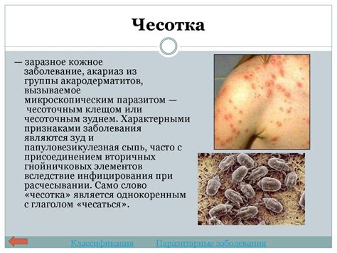 Венерические заболевания - презентация онлайн