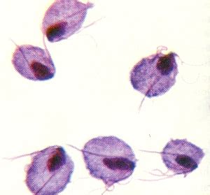 Trichomoniasis Pictures and photos