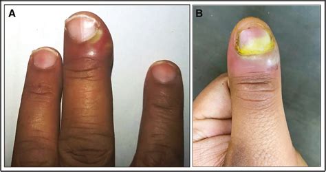 Journal of Cutaneous and Aesthetic Surgery