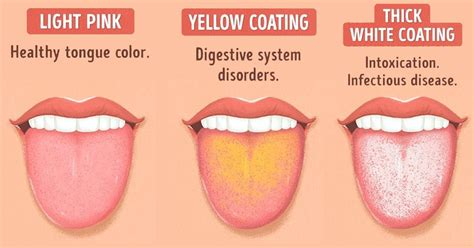 warnings  tongue        health healthy