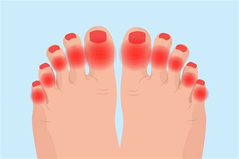 big toe sore on side – big toe pain causes – QNPH