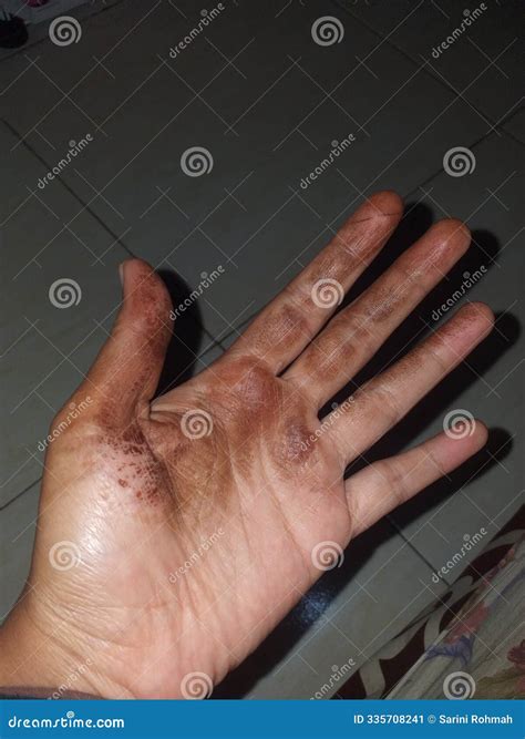 hand hit  ground stock image image  jewellery