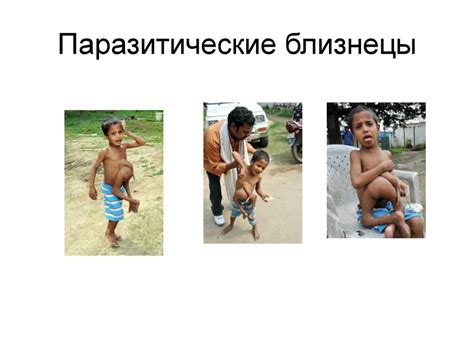 Близнецы в генетике - презентация онлайн