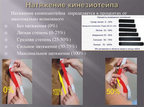 Кинезиотейпирование. История кинезиотейпирования - online presentation