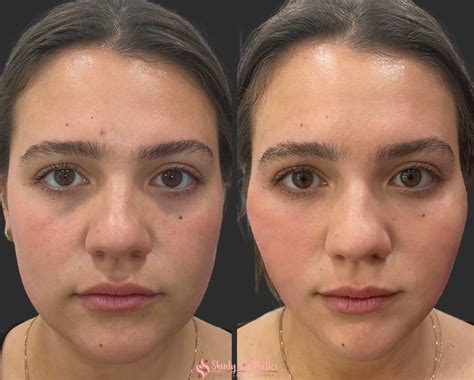 InfluencerGoneWild: The Most Unexpected Before & After Of 2024! Image 18