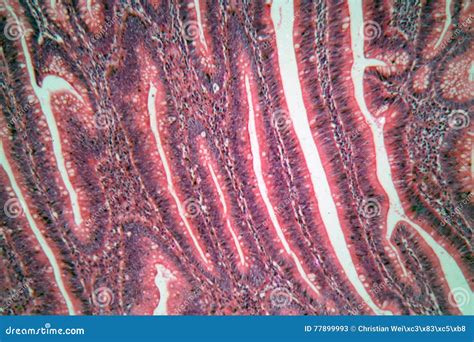intestine cells   microscope stock photography cartoondealer