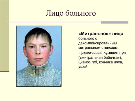 Семиотика заболеваний сердечно-сосудистой системы - презентация онлайн