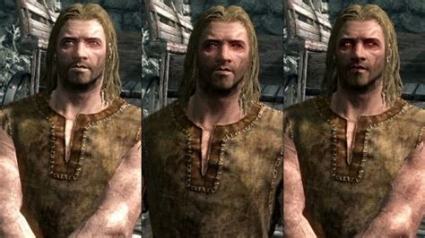 Skyrim cure vampirism