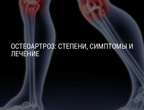 Остеоартроз: степени, симптомы и лечение
