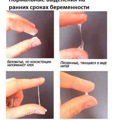 Коричневые выделения при беременности: причины и на каких сроках бывают
