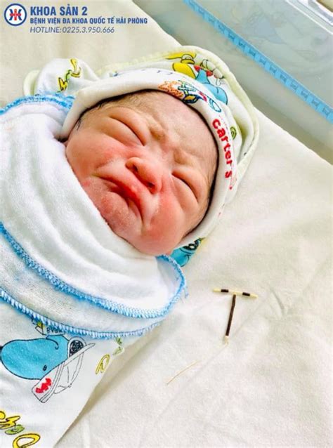 Bebe Que Nasceu Com O Diu Na Mão - Fotos surpreendentes mostram bebê segurando DIU na mão após o parto ...