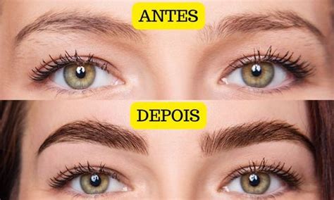Minoxidil Para Sobrancelha Antes E Depois - Minoxidil Para Sobrancelha Crescer Funciona?