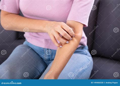 Woman Scratching the Itch on Her Arm Stock Photo - Image of home, lady ...