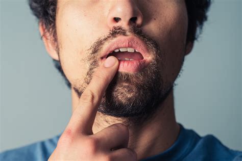 HIV Transmission From Oral Sex: What Are the Risks?