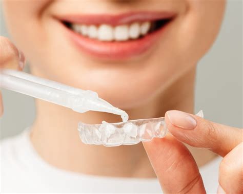 Clareador Dental Caseiro Qual O Melhor