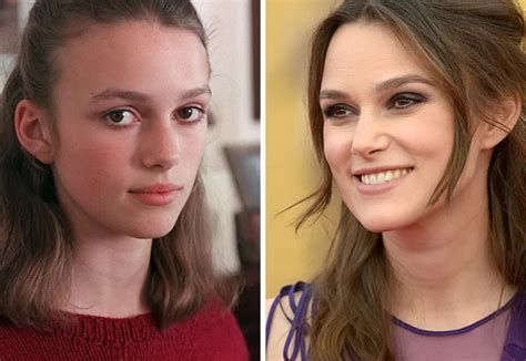 Keira Knightley Before and After Plastic Surgery: Nose, Lips, Boob