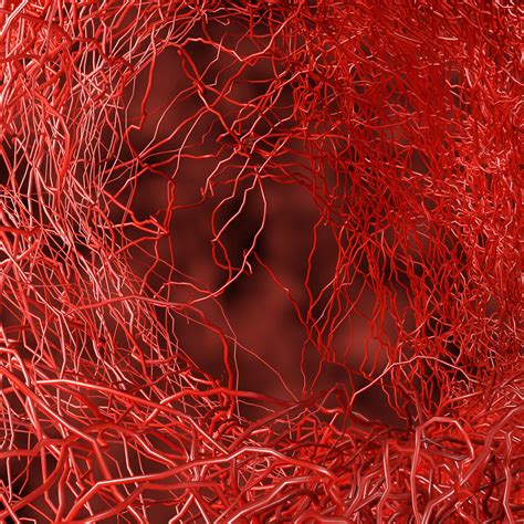 Coronary Micro-Vascular Disease – Small Vessels, Big Problem - McLeod