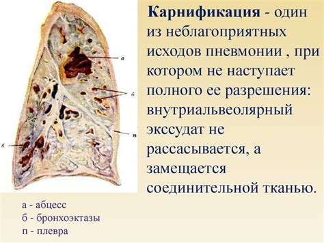 Карнификация: механизмы развития, значение в патологии - презентация онлайн