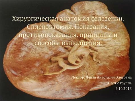 Хирургическая анатомия селезенки. Спленэктомия. Показания ...