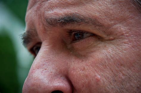 New stem cell treatment shows promise for reversing vision loss in