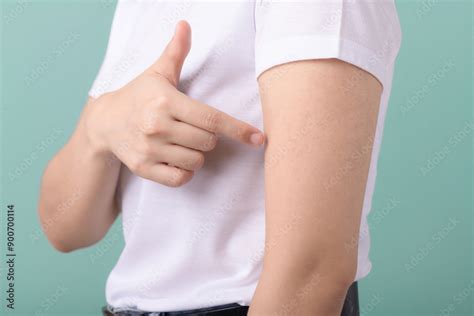 keratosis pilaris ingrown hairs chicken skin folliculitis