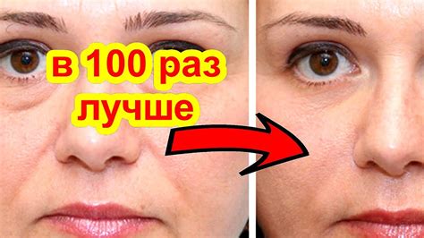 В100 Раз Лучше Чем Дорогой Крем! Домашний Рецепт Омоложение Лица Маска ...